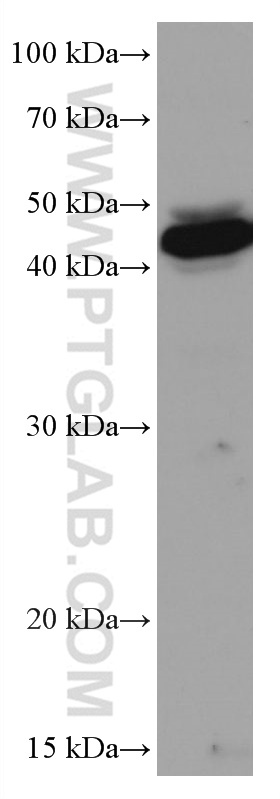 WB analysis of MCF-7 using 67116-1-Ig