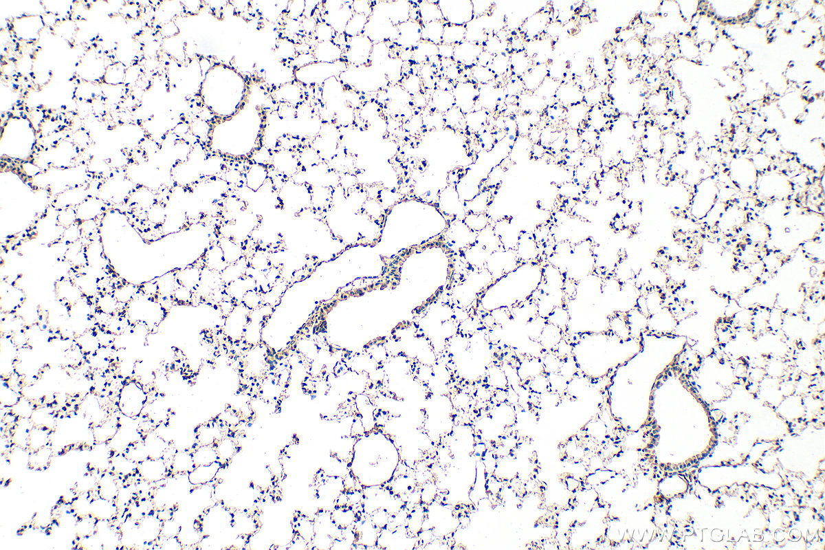 IHC staining of mouse lung using 30323-1-AP
