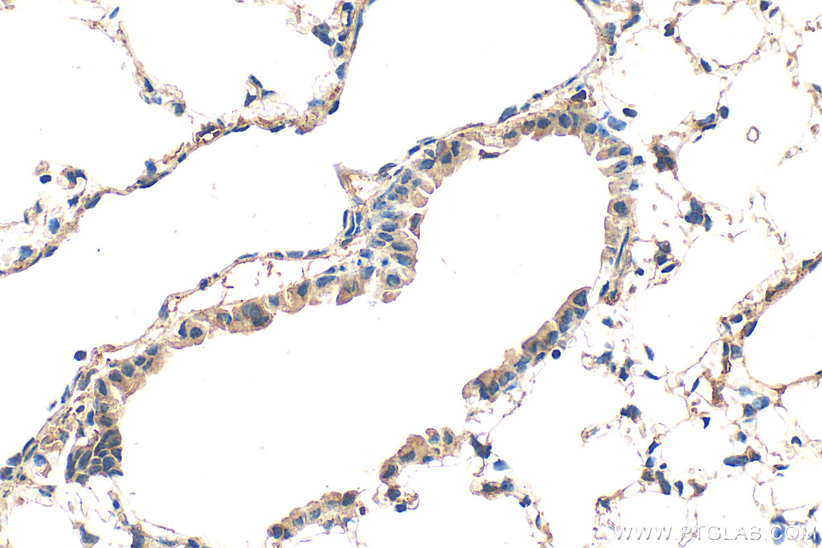 IHC staining of mouse lung using 30323-1-AP