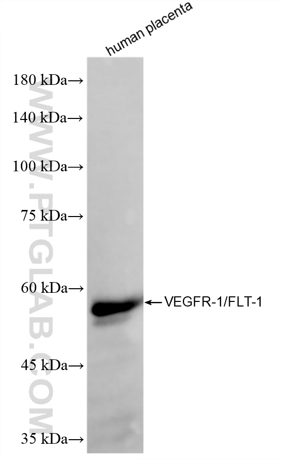 WB analysis of human placenta using 85844-2-RR (same clone as 85844-2-PBS) WB analysis of human placenta using 85844-2-RR (same clone as 85844-2-PBS)