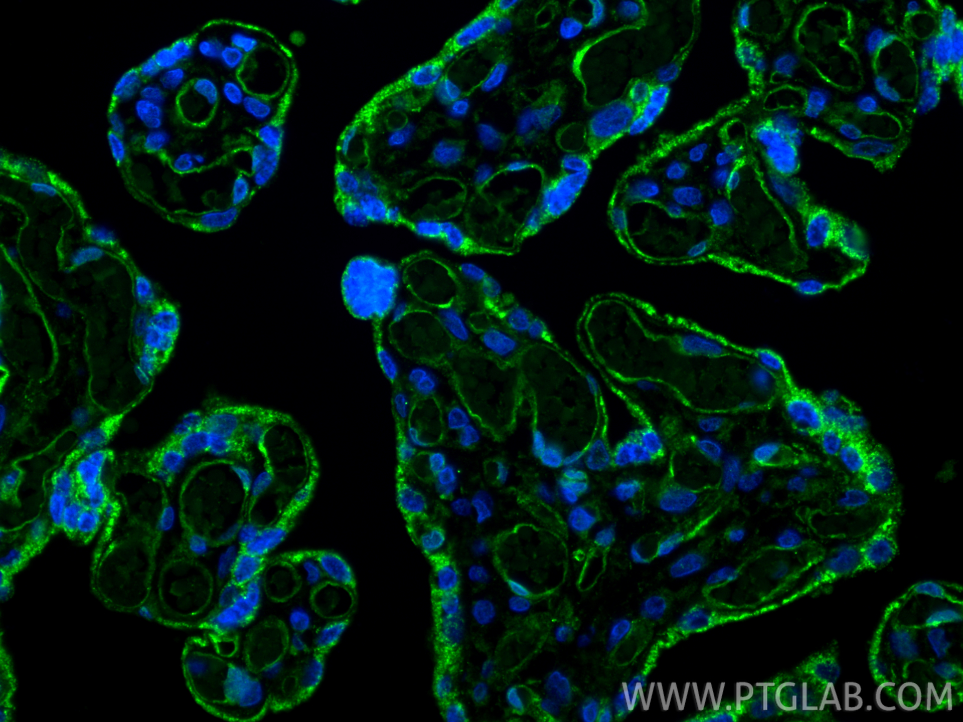 Immunofluorescent analysis of (4% PFA) fixed paraffin-embedded human placenta tissue using VEGFR2/KDR antibody (26415-1-AP) at dilution of 1:200 and CoraLite®488-Conjugated Goat Anti-Rabbit IgG(H+L) (<a class='green' href='/productredirect?CatalogNo=SA00013-2' target='_blank'>SA00013-2</a>). Heat mediated antigen retrieval with Tris-EDTA buffer (pH 9.0). IF Staining of human placenta using 26415-1-AP