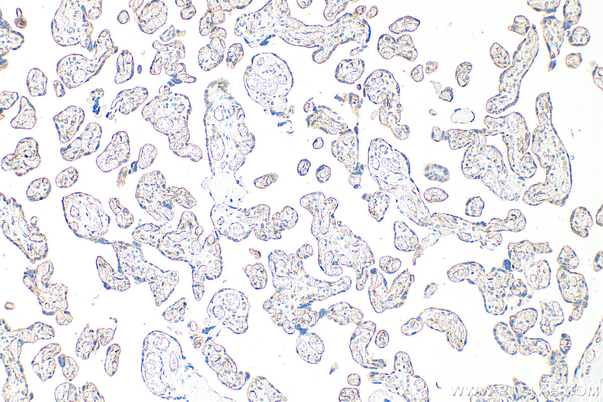 IHC staining of human placenta using 26415-1-AP