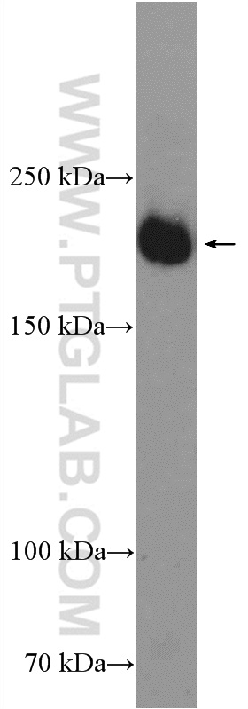 VEGFR2/KDR Polyclonal antibody