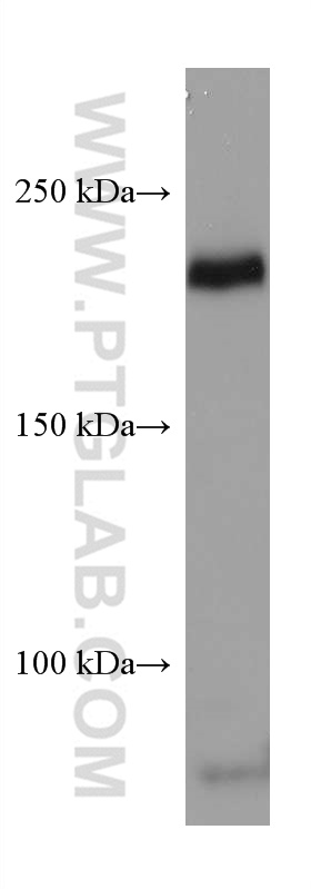 WB analysis of human placenta using 67407-1-Ig