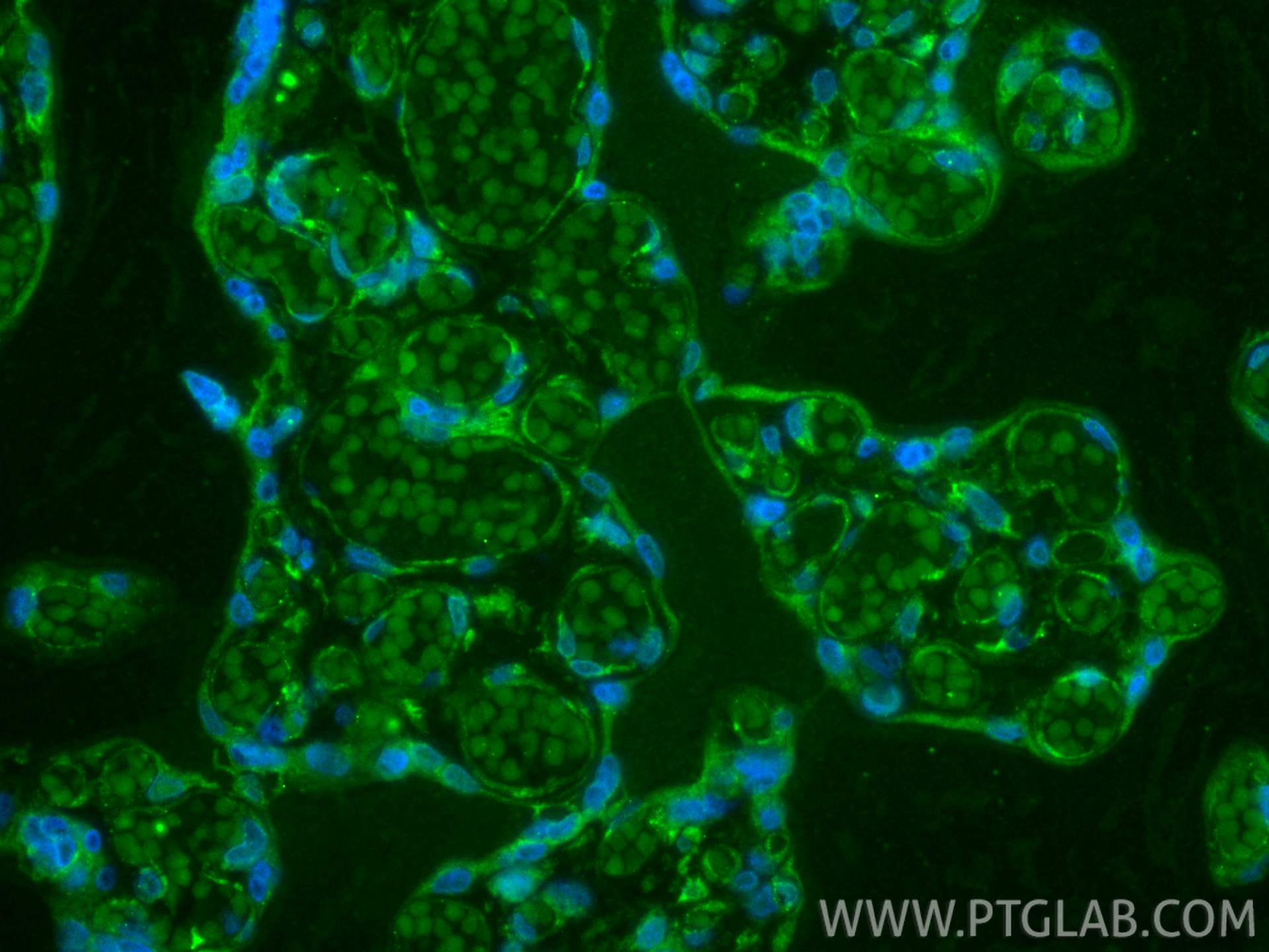 IF Staining of human placenta using CL488-83049-4