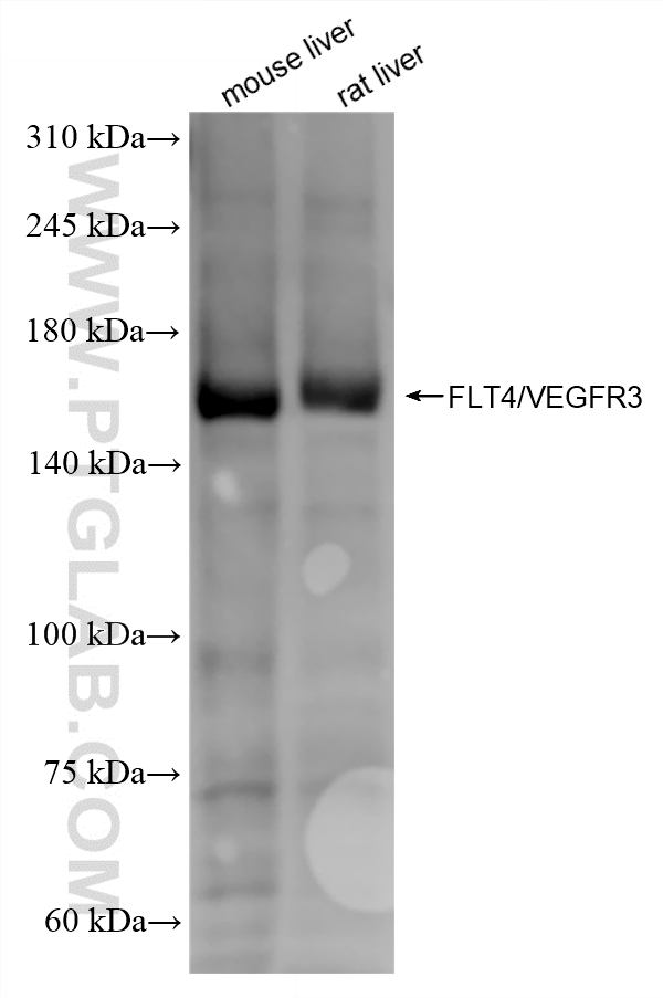 WB analysis using 87120-3-RR WB analysis using 87120-3-RR