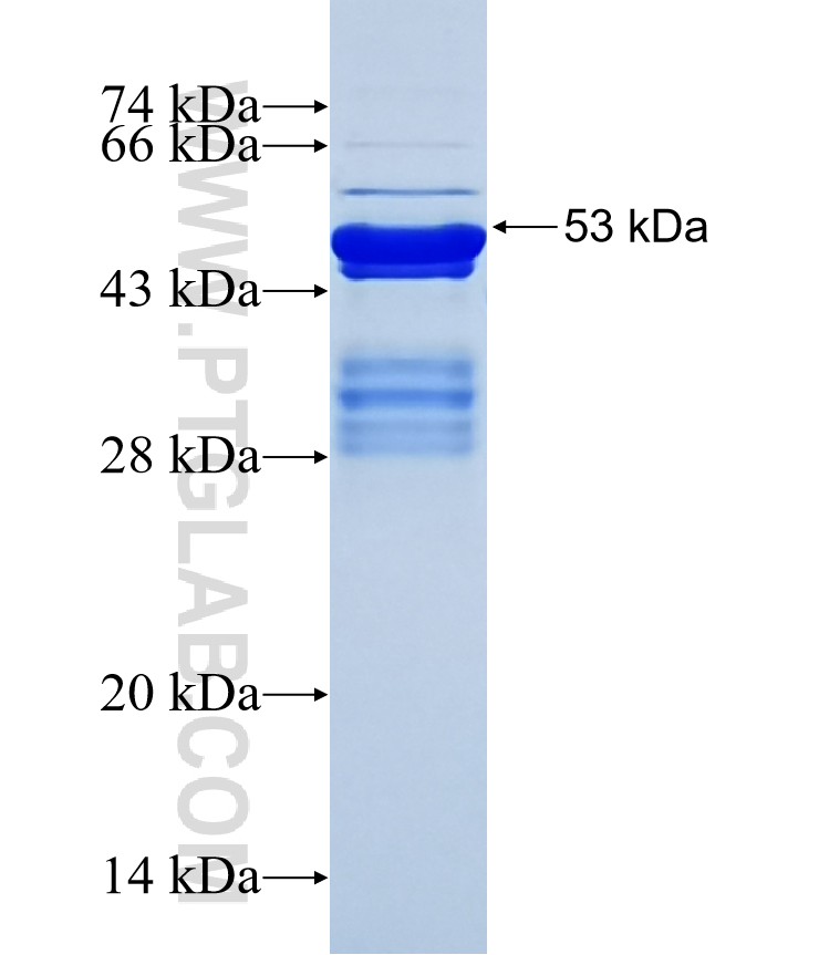 VENTX fusion protein Ag16009 SDS-PAGE VENTX fusion protein Ag16009 SDS-PAGE