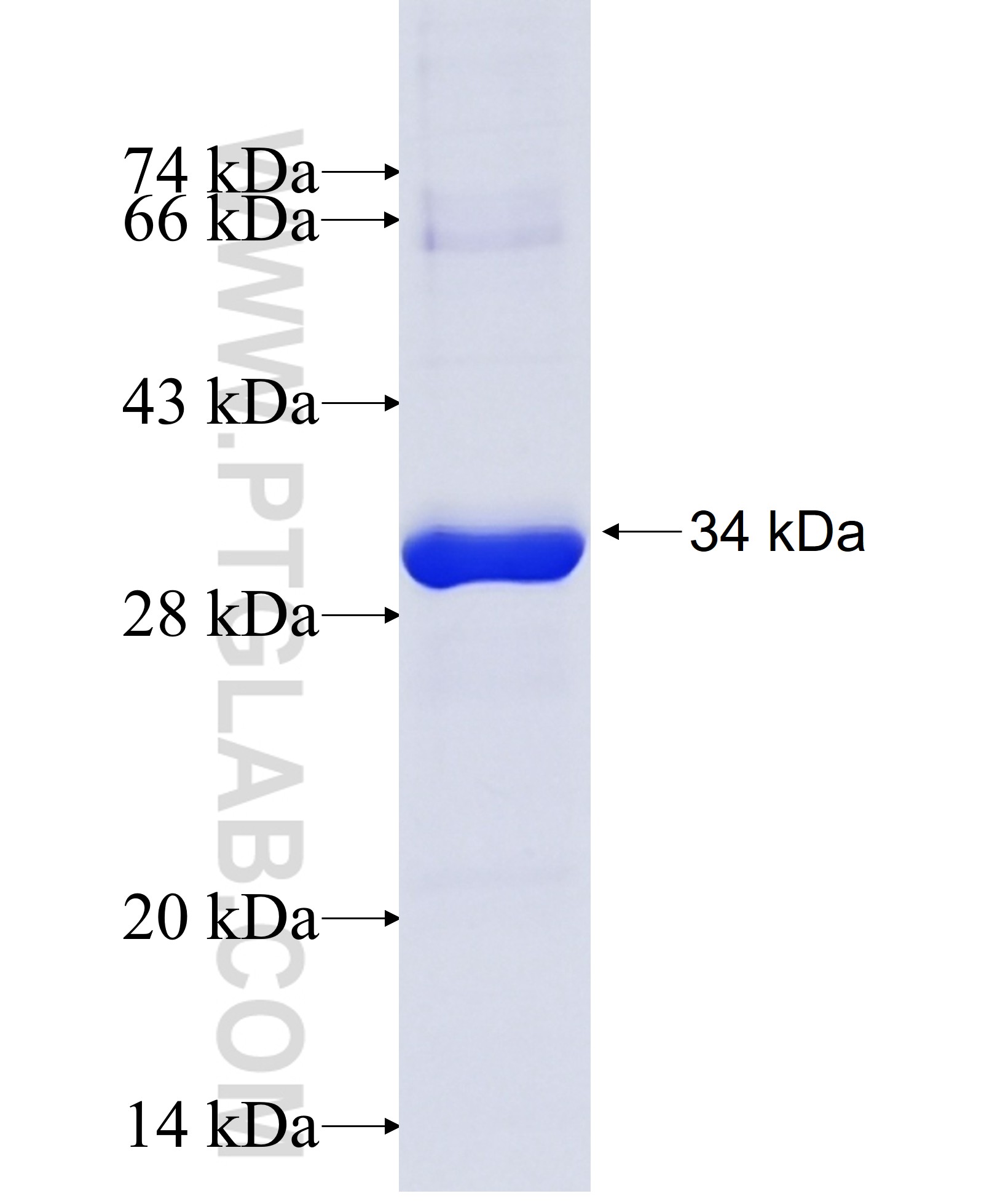 VGLL1 fusion protein Ag29617 SDS-PAGE VGLL1 fusion protein Ag29617 SDS-PAGE