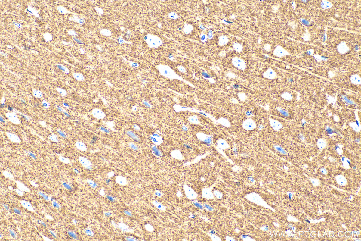 IHC staining of mouse brain using 29469-1-AP