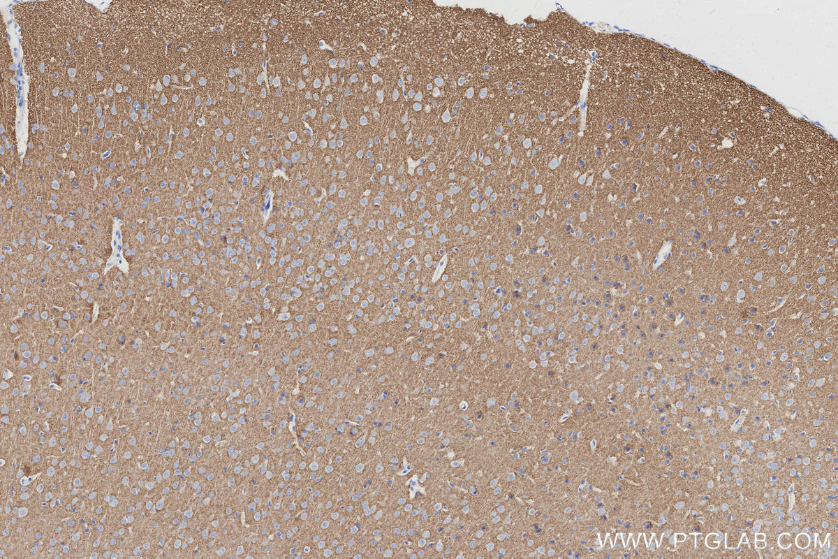 IHC staining of mouse brain using 29469-1-AP IHC staining of mouse brain using 29469-1-AP