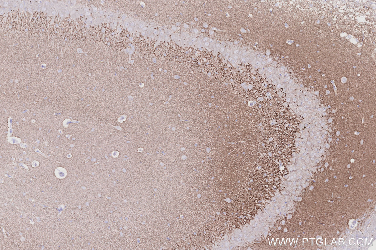 IHC staining of rat brain using 29469-1-AP IHC staining of rat brain using 29469-1-AP