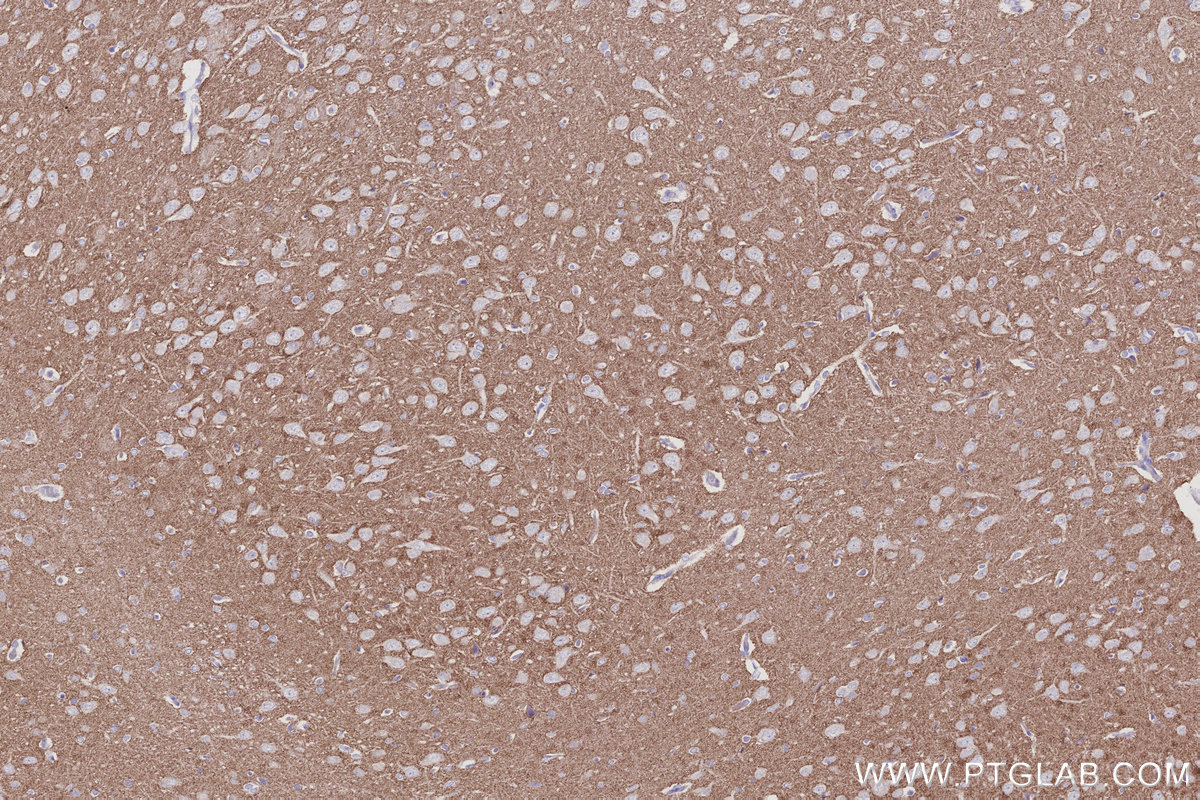 IHC staining of rat brain using 29469-1-AP IHC staining of rat brain using 29469-1-AP