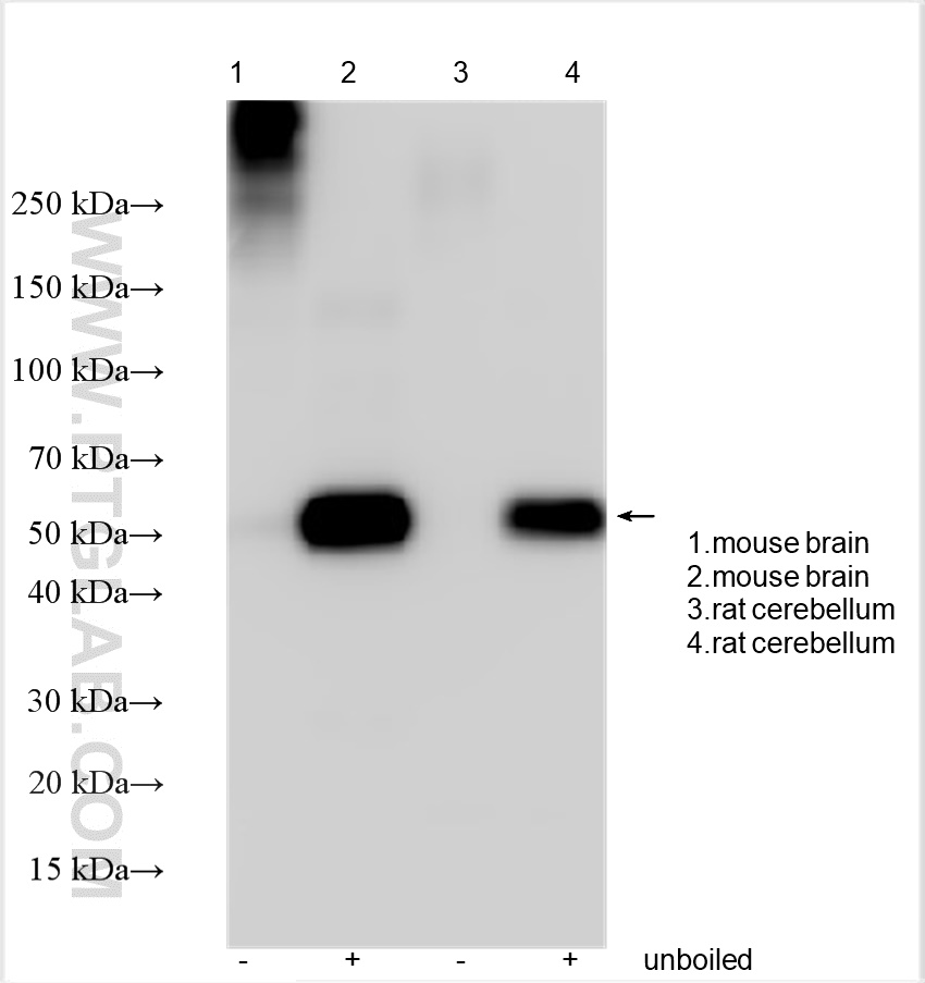 WB analysis of mouse brain using 29469-1-AP