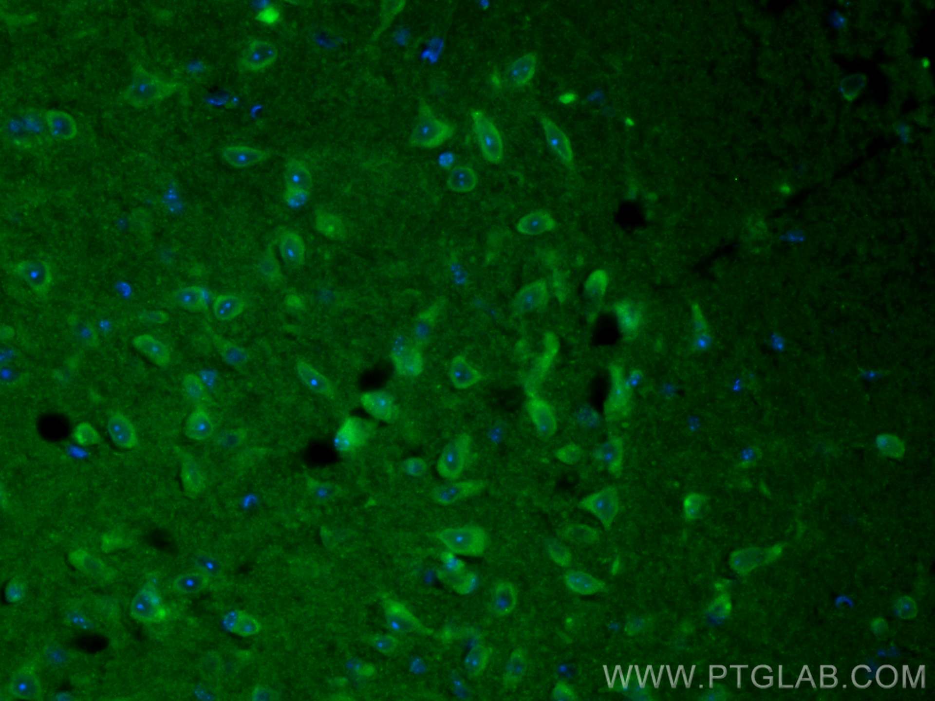 IF Staining of mouse brain using CL488-55491