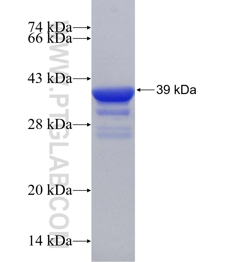 VGLUT1 fusion protein Ag31193 SDS-PAGE