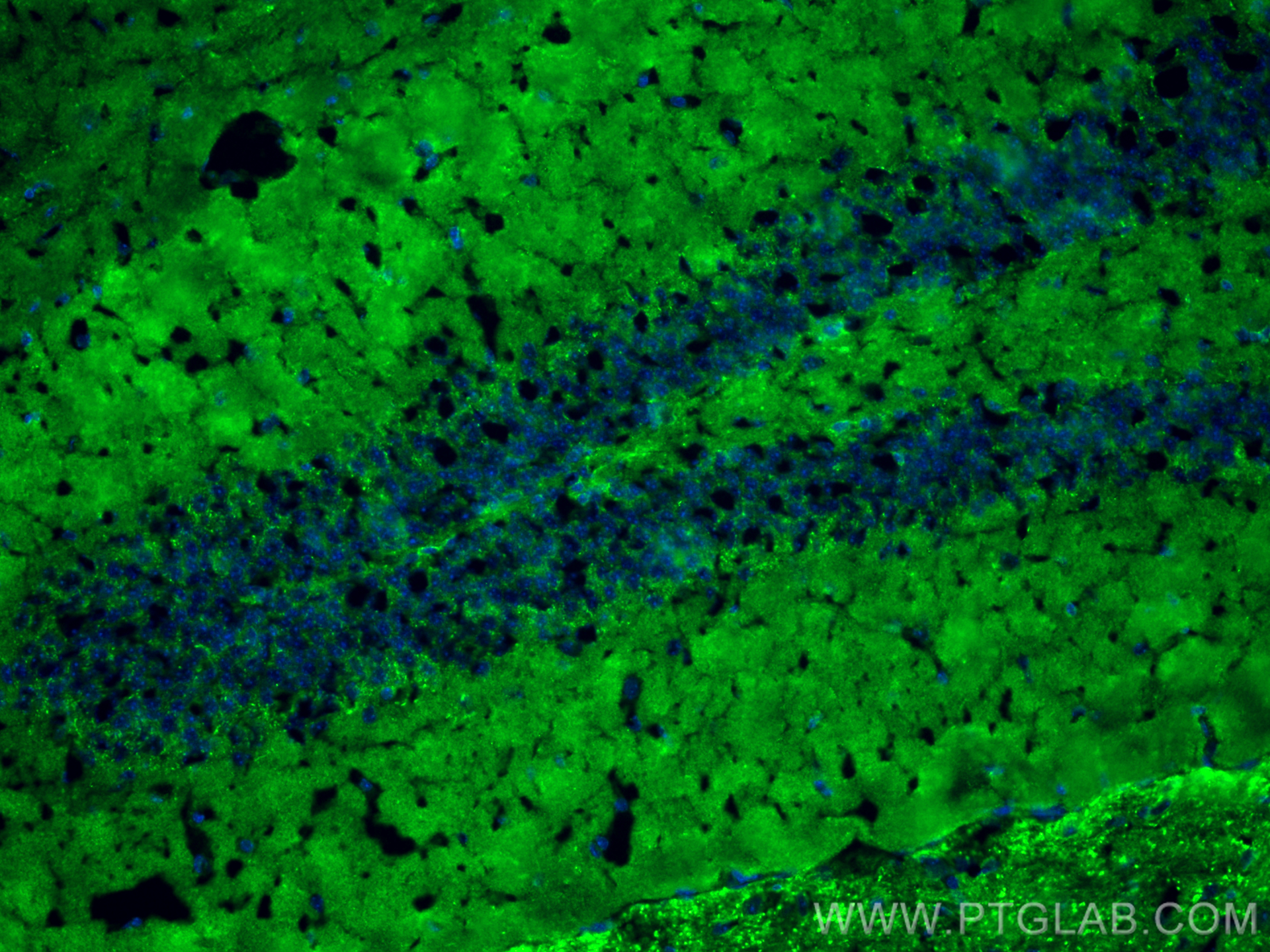 IF Staining of mouse brain using 29209-1-AP