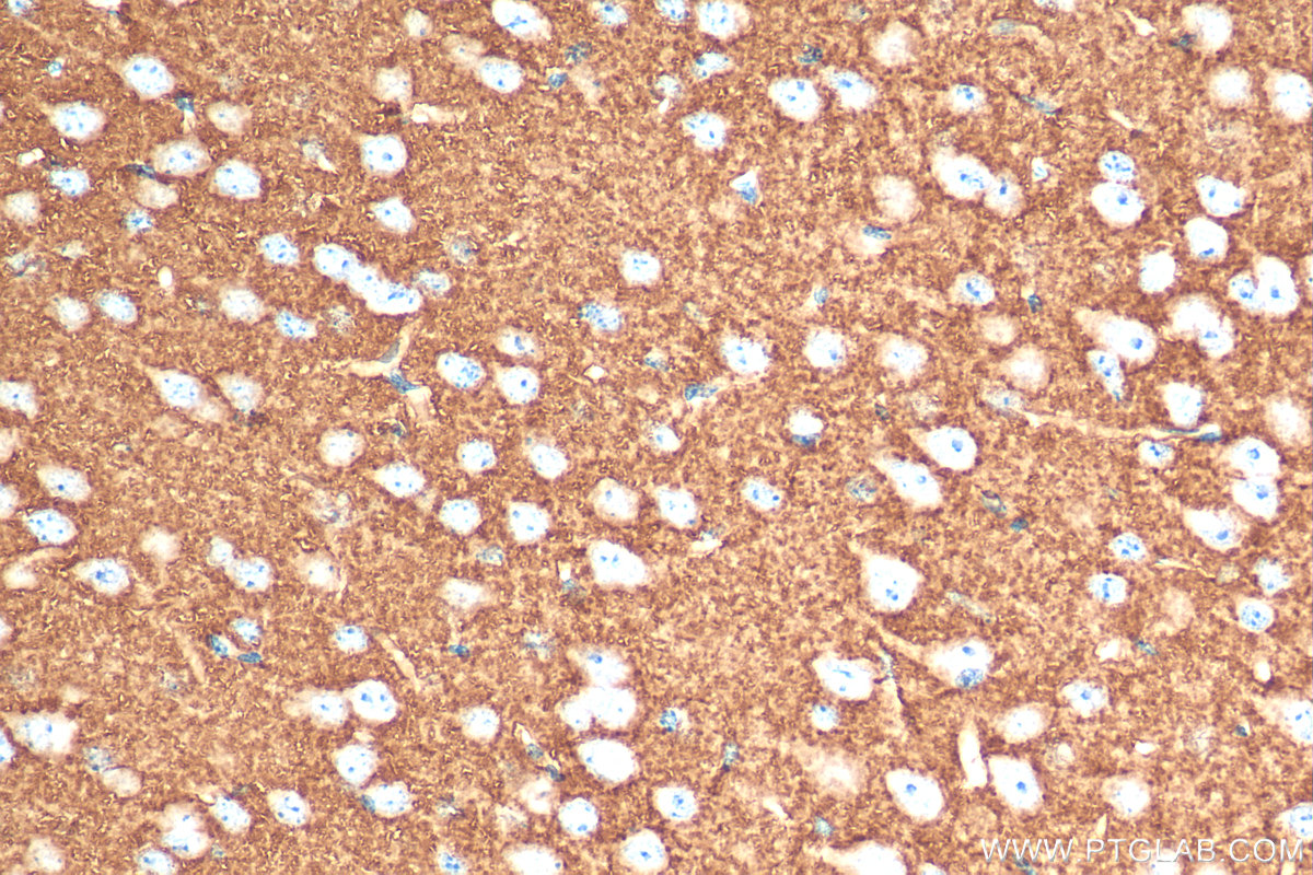 IHC staining of mouse brain using 29209-1-AP