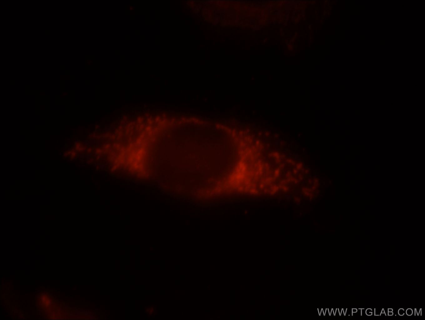 IF Staining of HepG2 using 16538-1-AP