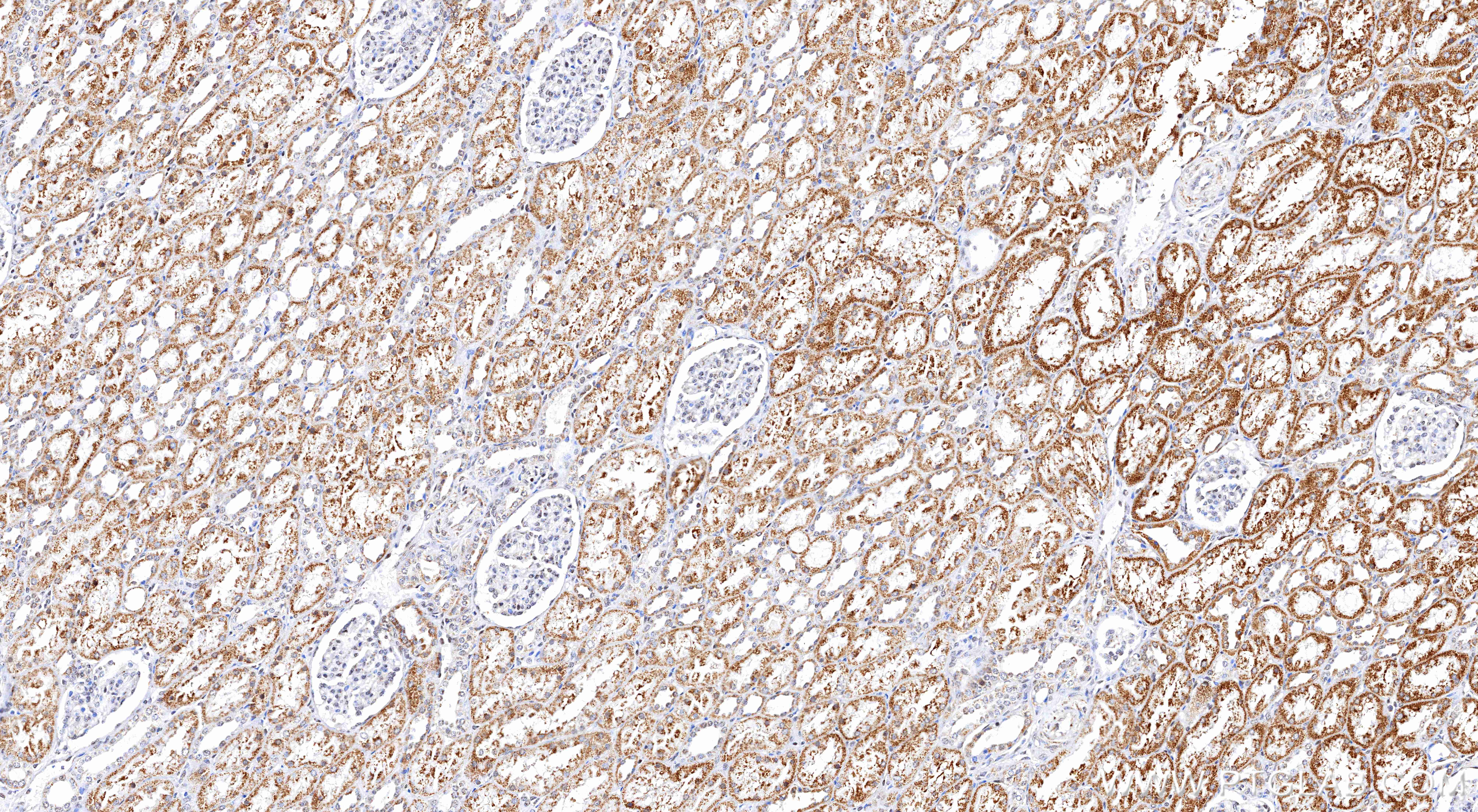 IHC staining of human kidney using 87374-3-RR (same clone as 87374-3-PBS) IHC staining of human kidney using 87374-3-RR (same clone as 87374-3-PBS)