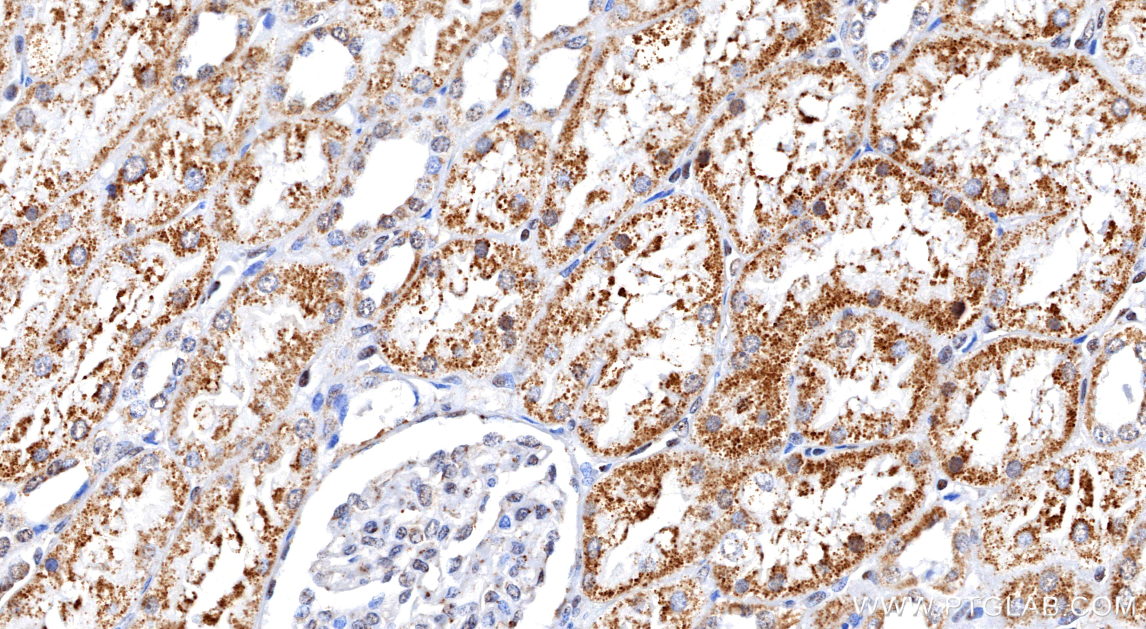 IHC staining of human kidney using 87374-3-RR (same clone as 87374-3-PBS) IHC staining of human kidney using 87374-3-RR (same clone as 87374-3-PBS)