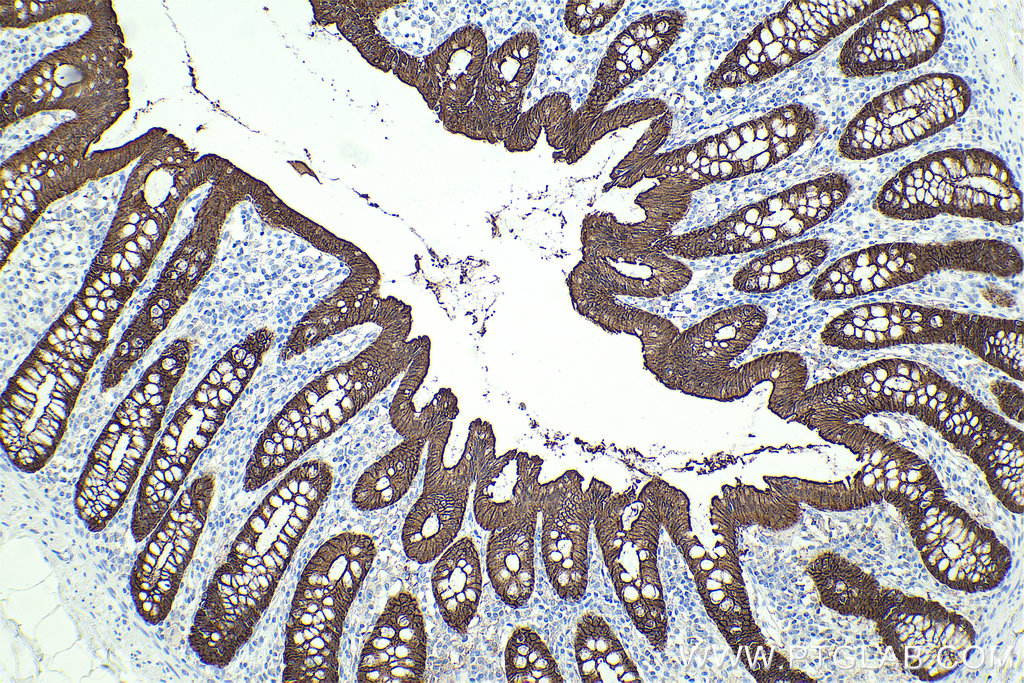 IHC staining of human colon using 66096-1-Ig