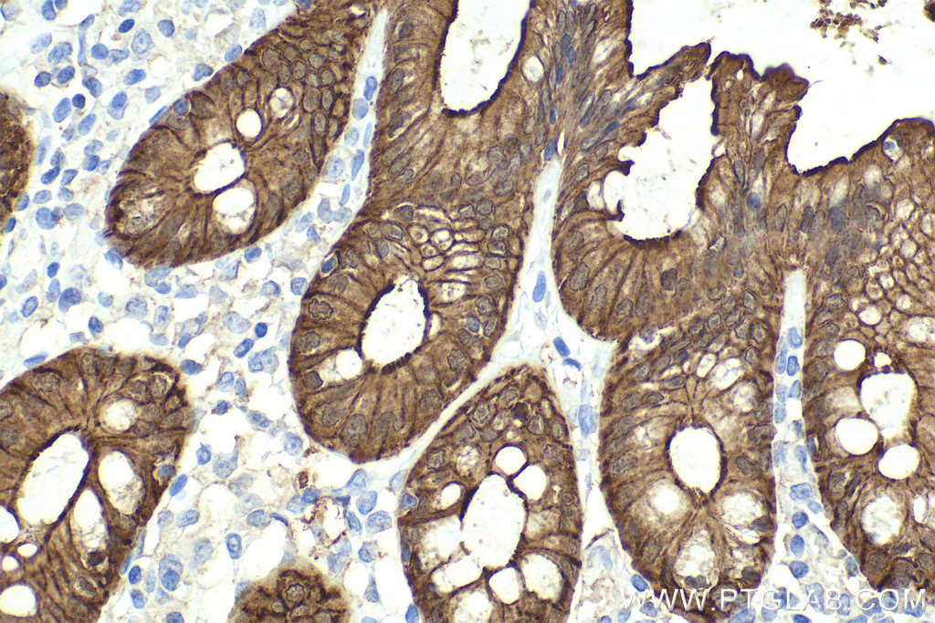 IHC staining of human colon using 66096-1-Ig