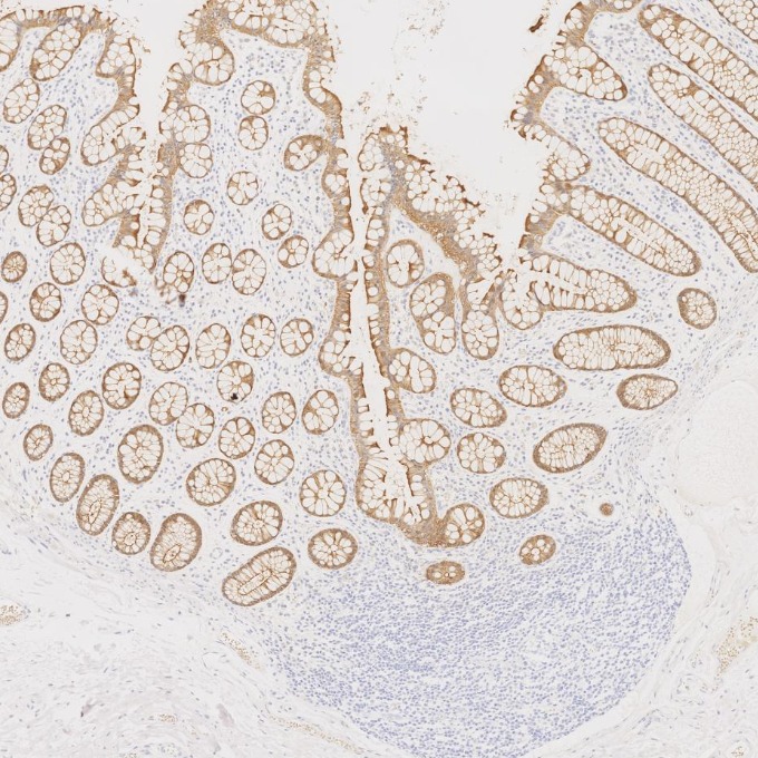 IHC staining of human large intestine using 66096-1-Ig IHC staining of human large intestine using 66096-1-Ig