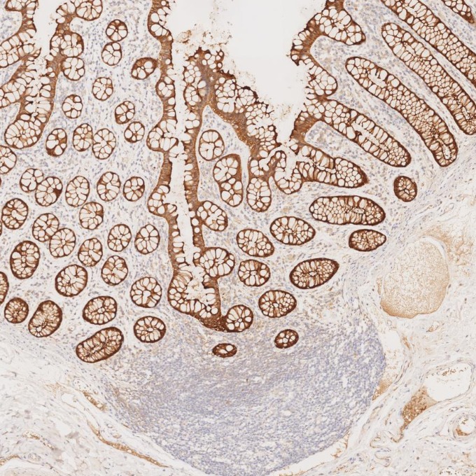 IHC staining of human large intestine using 66096-1-Ig IHC staining of human large intestine using 66096-1-Ig