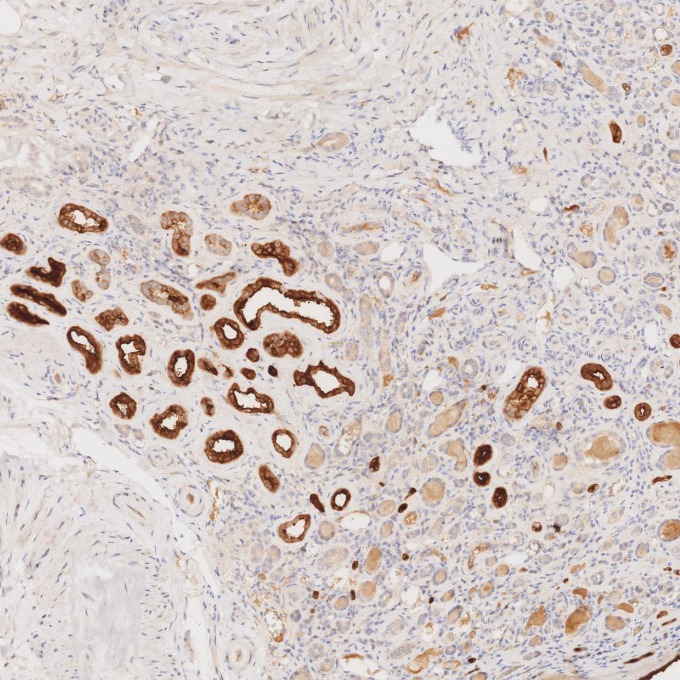 IHC staining of human kidney using 66096-1-Ig IHC staining of human kidney using 66096-1-Ig