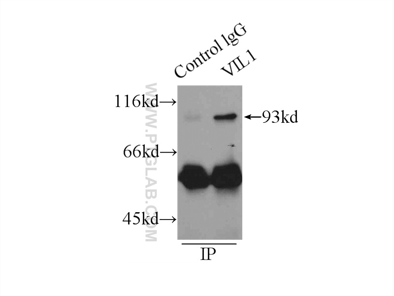 IP experiment of mouse kidney using 66096-1-Ig