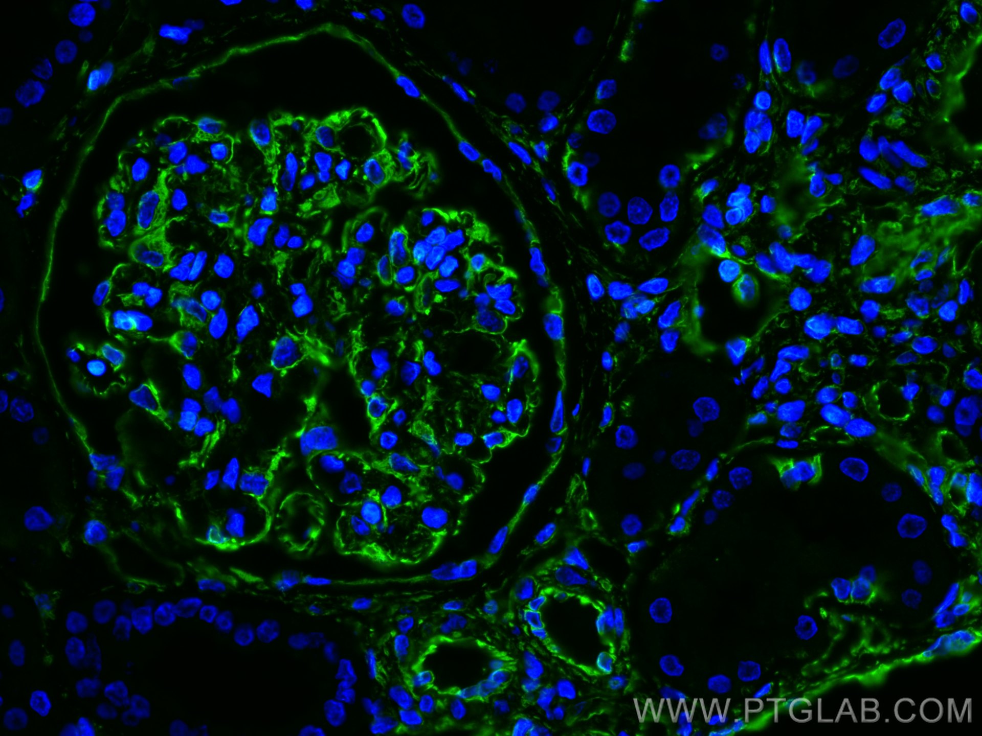 IF Staining of human kidney using 10366-1-AP