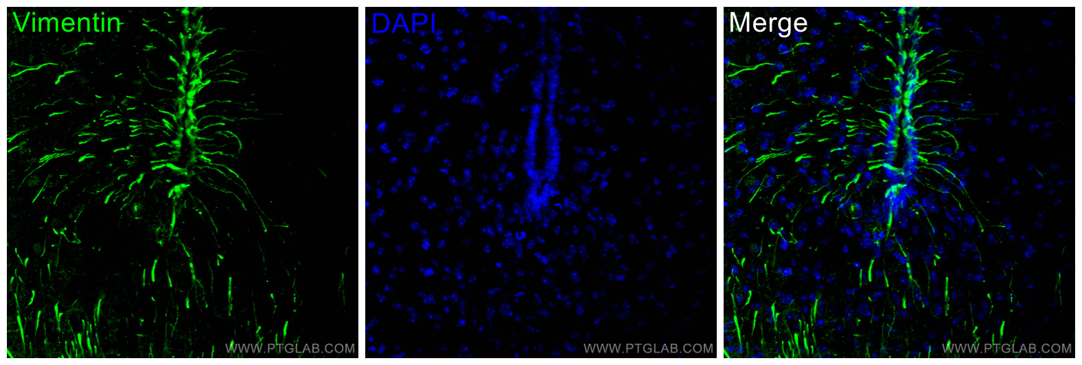 IF Staining of mouse brain using 10366-1-AP