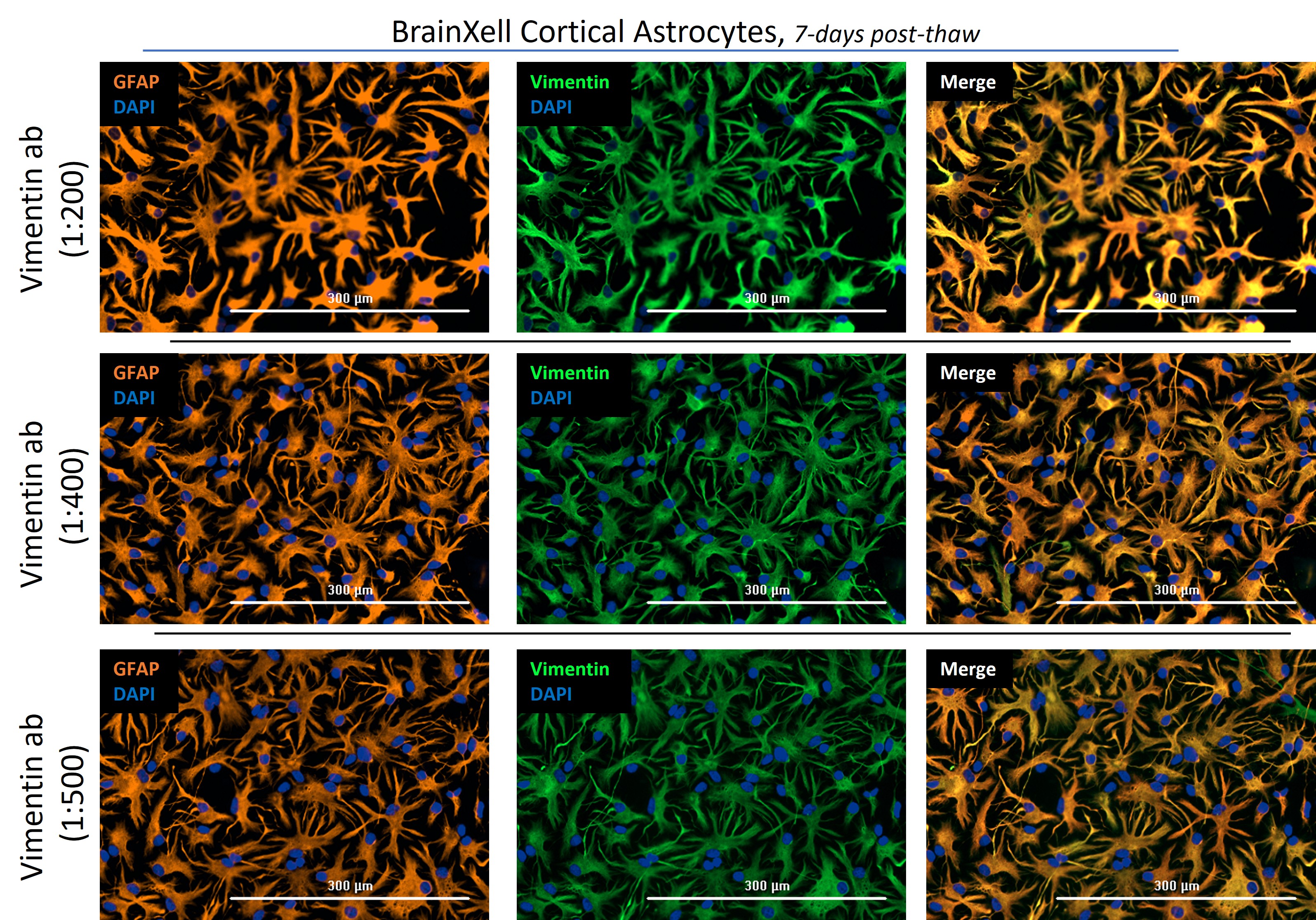 IF Staining of hiPSC-derived cortical astrocytes (7 DIV) using 10366-1-AP