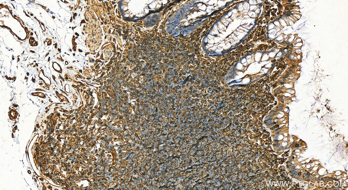IHC staining of human colon using 22031-1-AP