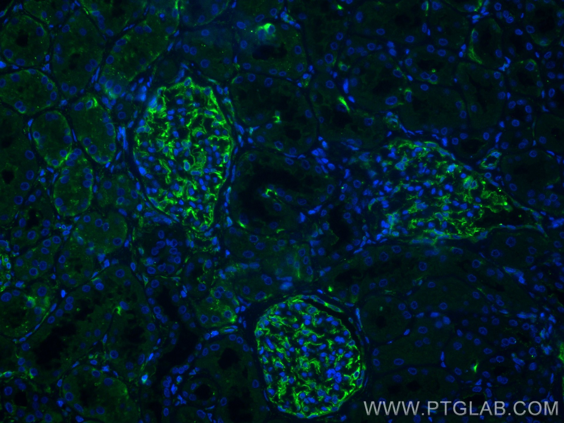 IF Staining of human kidney using 22031-1-AP