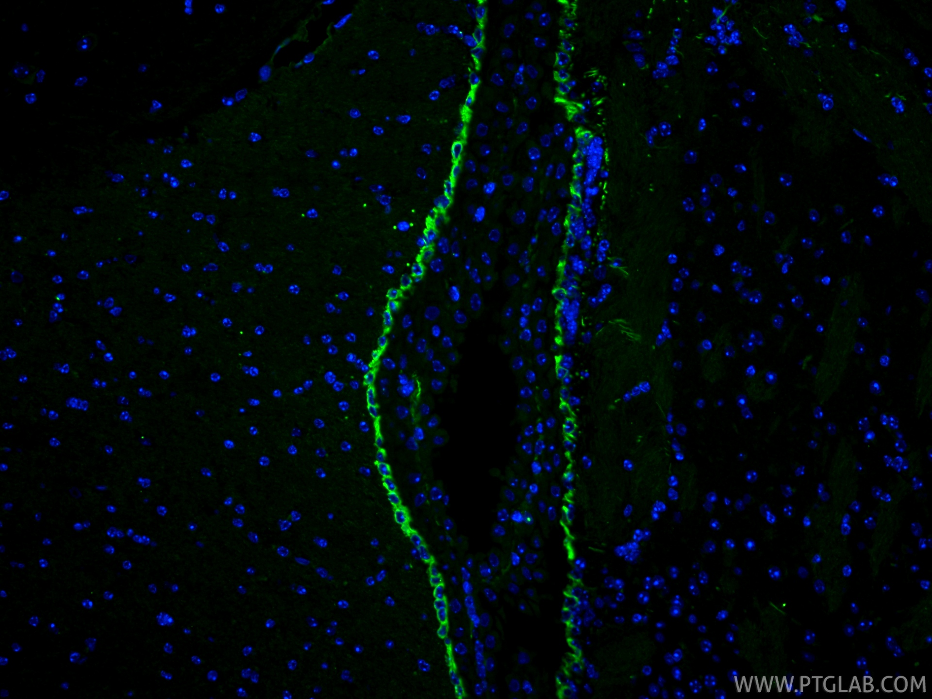 IF Staining of mouse brain using 22031-1-AP