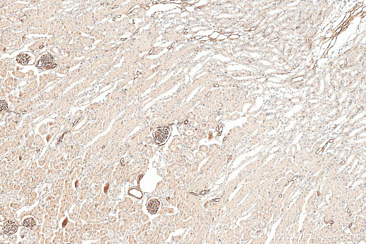 IHC staining of mouse kidney using 22031-1-AP IHC staining of mouse kidney using 22031-1-AP