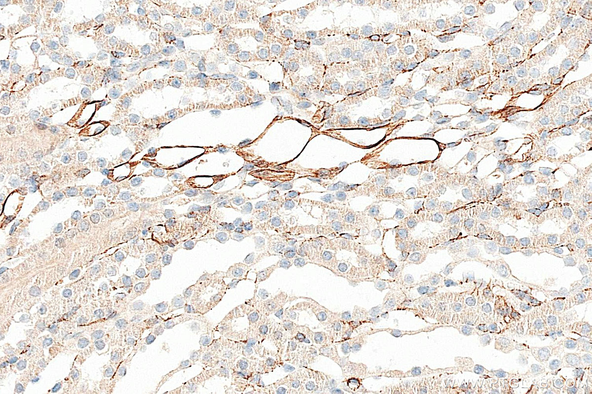 IHC staining of mouse kidney using 22031-1-AP IHC staining of mouse kidney using 22031-1-AP