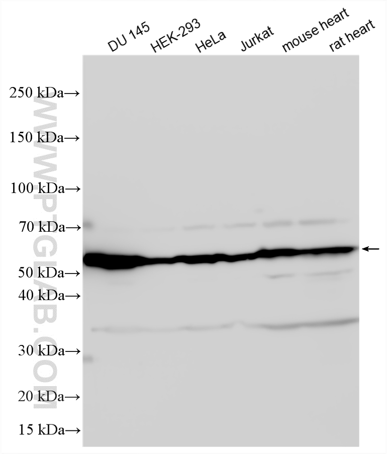 Various lysates were subjected to SDS PAGE followed by western blot with 22031-1-AP (Vimentin antibody) at dilution of 1:4000 incubated at room temperature for 1.5 hours. WB analysis using 22031-1-AP