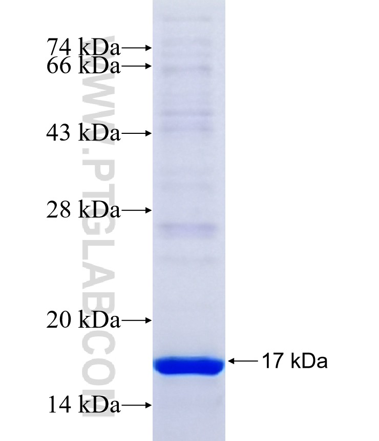 Vimentin fusion protein Ag17441 SDS-PAGE