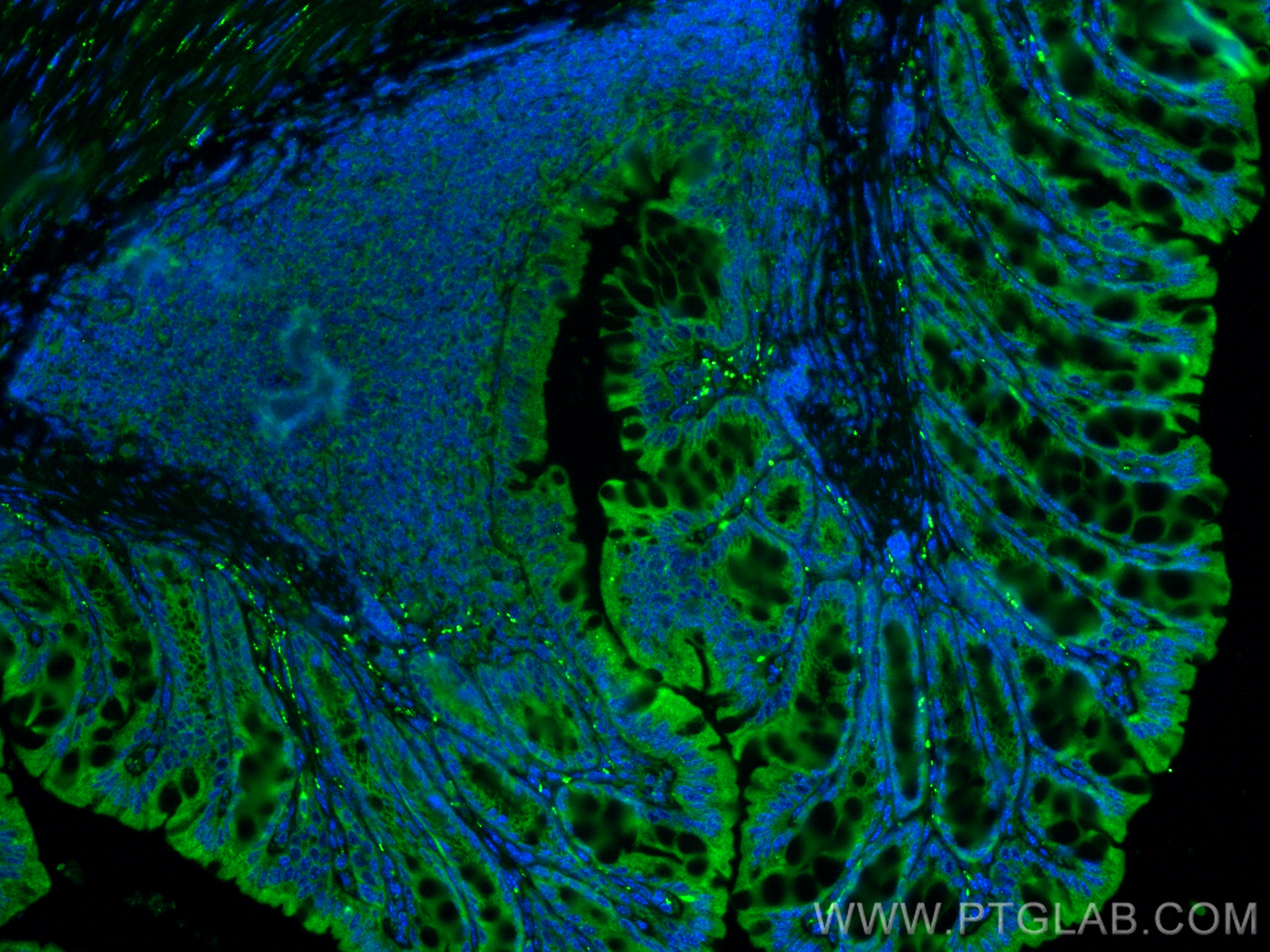 Immunofluorescent analysis of (4% PFA) fixed paraffin-embedded mouse colon tissue using VIP antibody (16233-1-AP) at dilution of 1:200 and CoraLite®488-Conjugated Goat Anti-Rabbit IgG(H+L) (<a class='green' href='/productredirect?CatalogNo=SA00013-2' target='_blank'>SA00013-2</a>). Heat mediated antigen retrieval with Tris-EDTA buffer (pH 9.0). IF Staining of mouse colon using 16233-1-AP