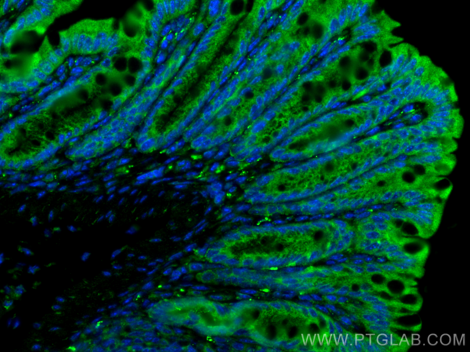 Immunofluorescent analysis of (4% PFA) fixed paraffin-embedded mouse colon tissue using VIP antibody (16233-1-AP) at dilution of 1:200 and CoraLite®488-Conjugated Goat Anti-Rabbit IgG(H+L) (<a class='green' href='/productredirect?CatalogNo=SA00013-2' target='_blank'>SA00013-2</a>). Heat mediated antigen retrieval with Tris-EDTA buffer (pH 9.0). IF Staining of mouse colon using 16233-1-AP