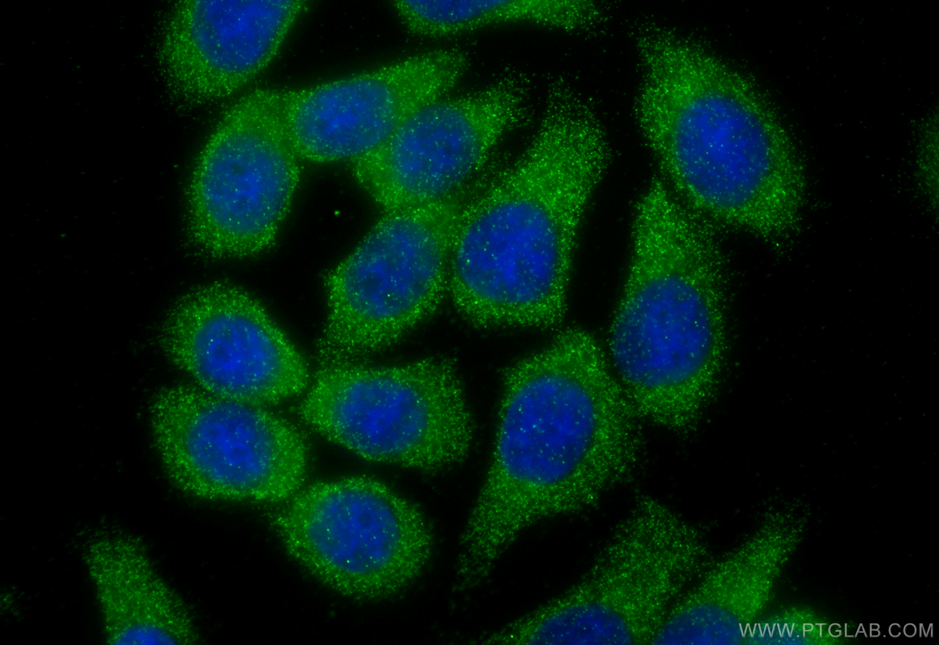 Immunofluorescent analysis of (-20°C Ethanol) fixed HT-29 cells using VIP antibody (16233-1-AP) at dilution of 1:400 and CoraLite®488-Conjugated Goat Anti-Rabbit IgG(H+L) (<a class='green' href='/productredirect?CatalogNo=SA00013-2' target='_blank'>SA00013-2</a>). IF Staining of HT-29 using 16233-1-AP