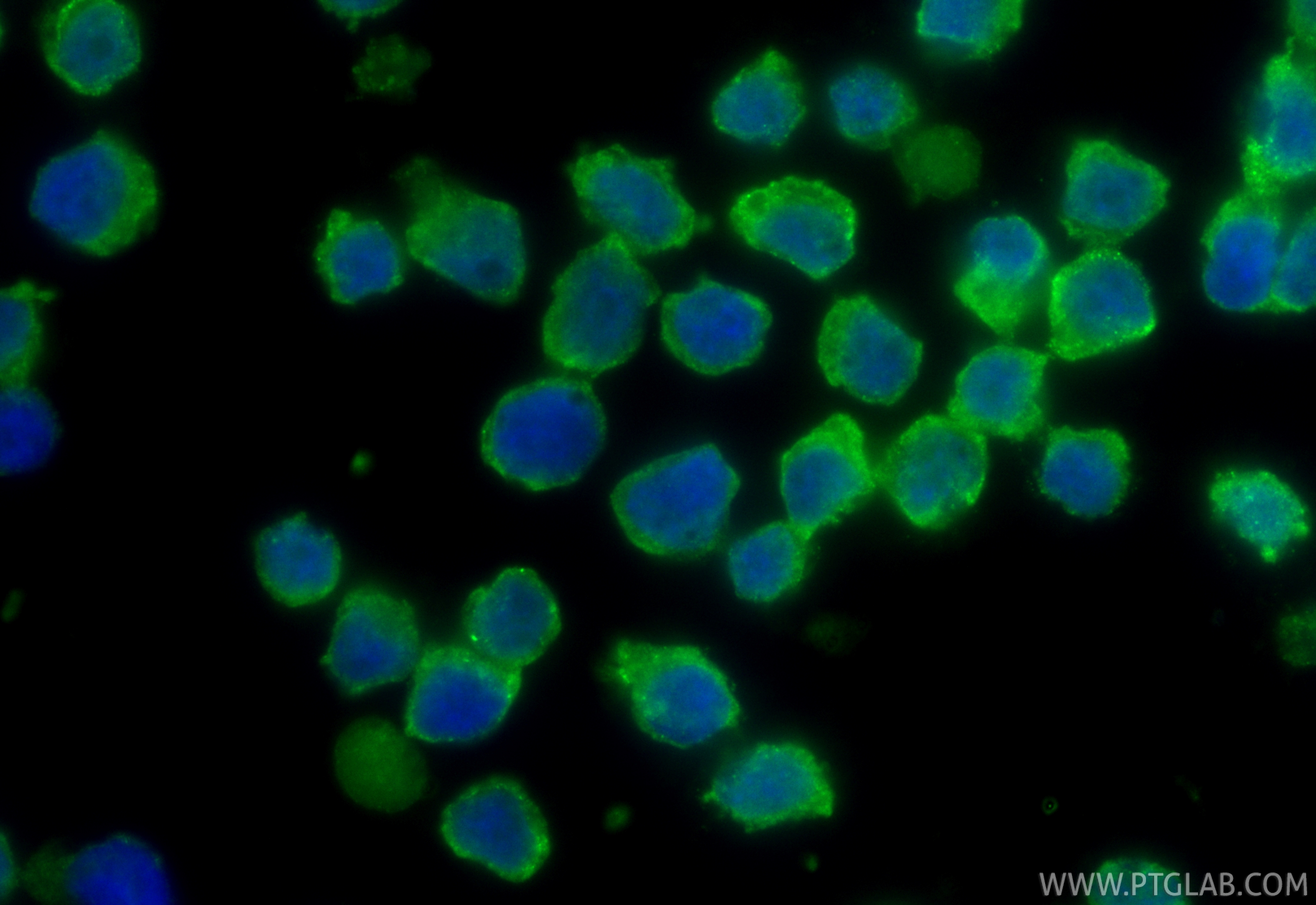 IF Staining of COLO 320 using CL488-16233 IF Staining of COLO 320 using CL488-16233