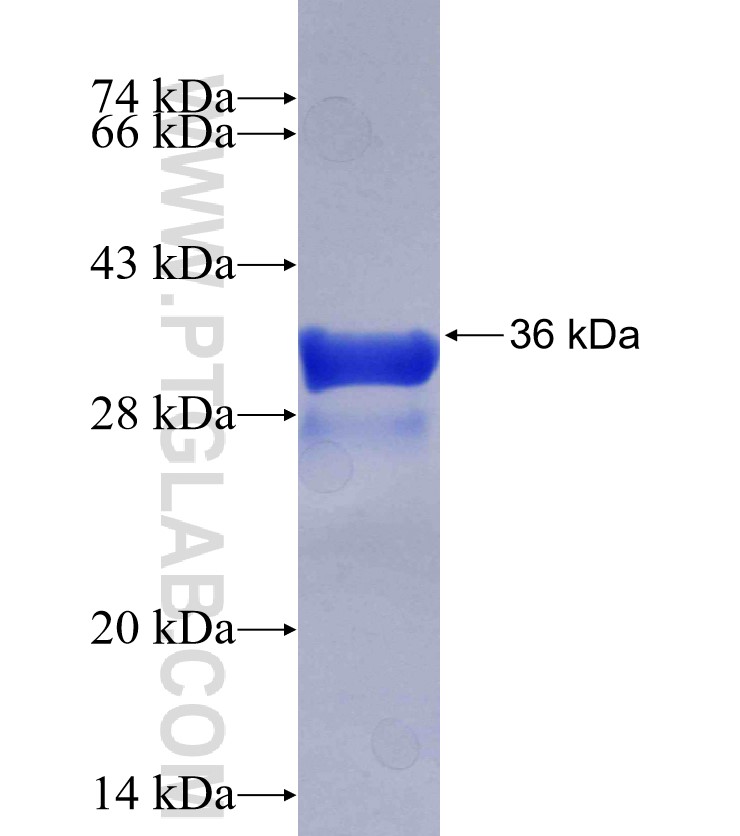 VIP fusion protein Ag29602 SDS-PAGE