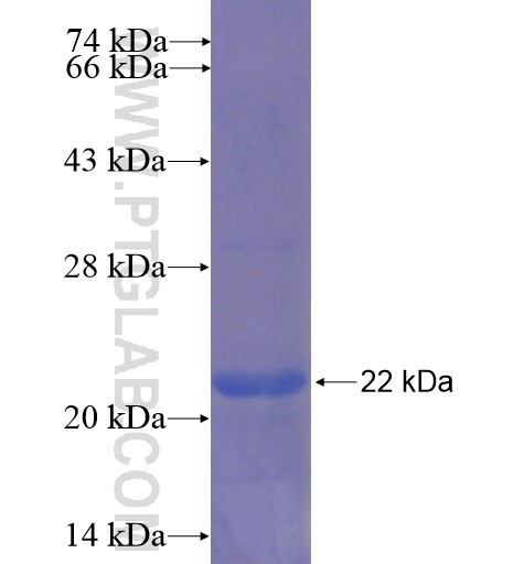 VIP fusion protein Ag15130 SDS-PAGE