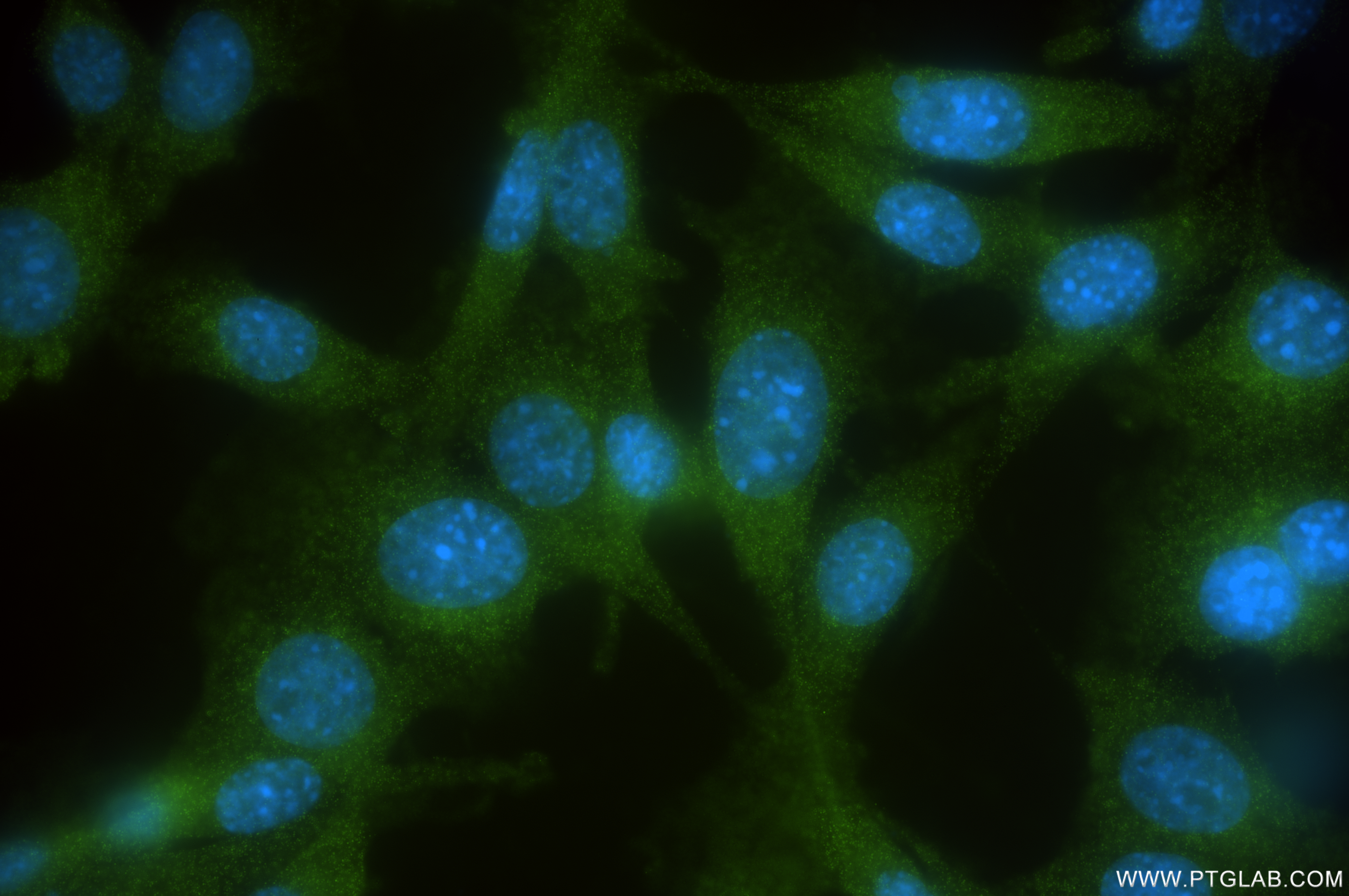 IF Staining of NIH/3T3 using 84320-2-RR (same clone as 84320-2-PBS)