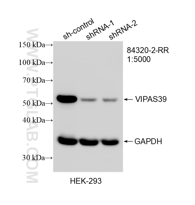 WB result of VIPAS39 antibody (<a class='green' href='/productredirect?CatalogNo=84320-2-RR' target='_blank'>84320-2-RR</a>; 1:5000; incubated at room temperature for 1.5 hours) with sh-Control and sh-VIPAS39 transfected HEK-293 cells. This data was developed using the same antibody clone with 84320-2-PBS in a different storage buffer formulation. WB analysis of HEK-293 using 84320-2-RR (same clone as 84320-2-PBS)