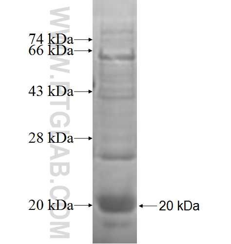 VIPR1 fusion protein Ag7248 SDS-PAGE VIPR1 fusion protein Ag7248 SDS-PAGE