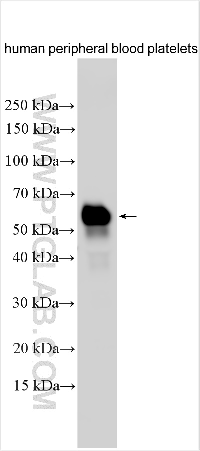 WB analysis using 31619-1-AP